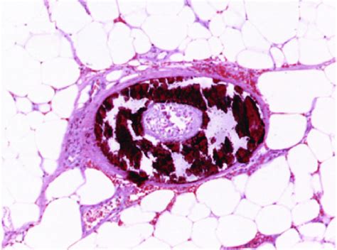 Imagen Histológica En Hematoxilina Eosina Download Scientific Diagram