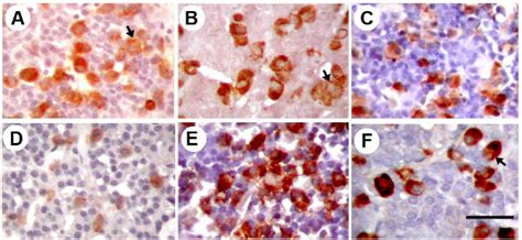 Representative Microphotographs Of Lh Ir Cells In The Ap Of Mini And