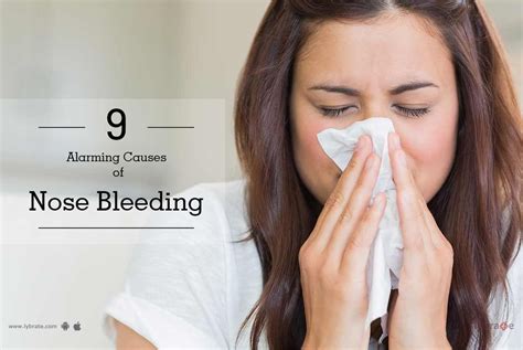 You shouldn't ignore these 9 alarming causes of nose bleed! - By Dr ...