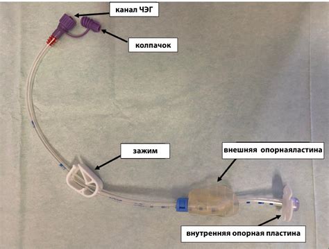 Применение и уход за зондом при чрезкожной эндоскопической гастростоме ...