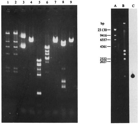 Restriction Enzyme Analysis Of Plasmid Dna Isolated From An E Coli Download Scientific Diagram