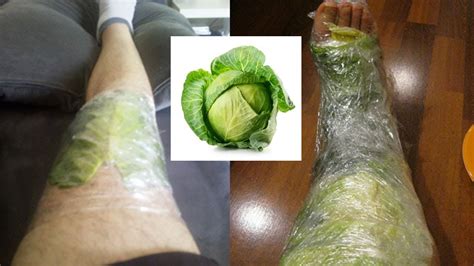 She Put Cabbage Leaves On Her Knee At Night See Amazing Results After 1 Month Youtube