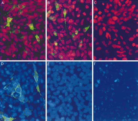 Expression Of Wild Type And Mutant Ccr Qt Quail Cells Were