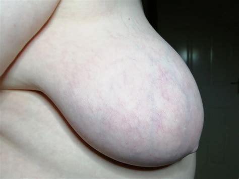 Side Boob Artificial Light Indoors 52 Nude Pics XHamster