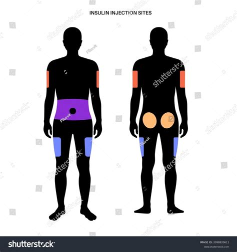 1,292 Skin Injection Anatomy Images, Stock Photos & Vectors | Shutterstock