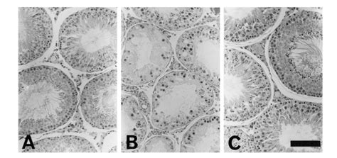 Histology Of Control Testis A And Efferent Duct Ligated Testis B