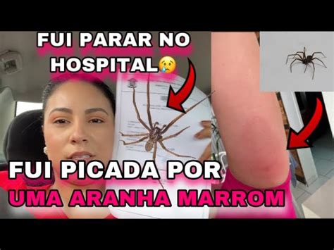Picada De Aranha Marrom - Picada De Aranha Marrom Evoluo