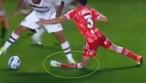 Jogador Quebrou A Perna - Imagens fortes - Jogador do Argentinos Juniors quebra a perna, e ...