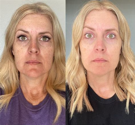 Collagen Results