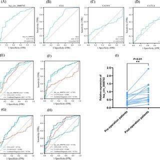 Evaluation Of The Diagnostic Value Of Hsa Circ 0000702 In GC AC ROC