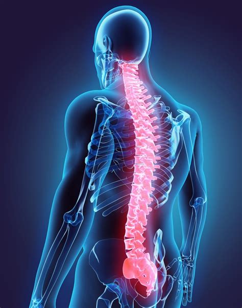 How Car And Truck Accidents Can Lead To Spinal Cord Injuries In Georgia