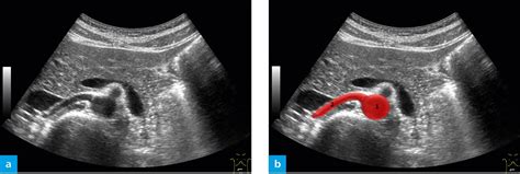 Arteries Radiology Key