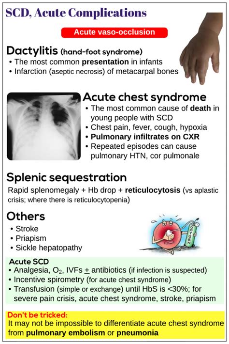 Sickle cell disease, acute complications - Medicine Keys for MRCPs