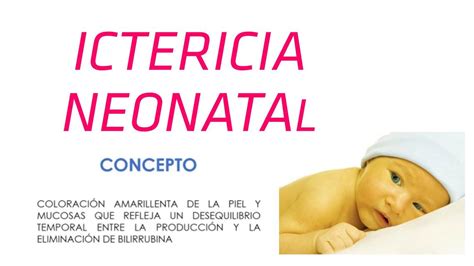 Ictericia Neonatal Janeth UDocz