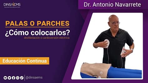 C Mo Colocar Las Palas O Parches Electrodos Durante La Desfibrilaci N