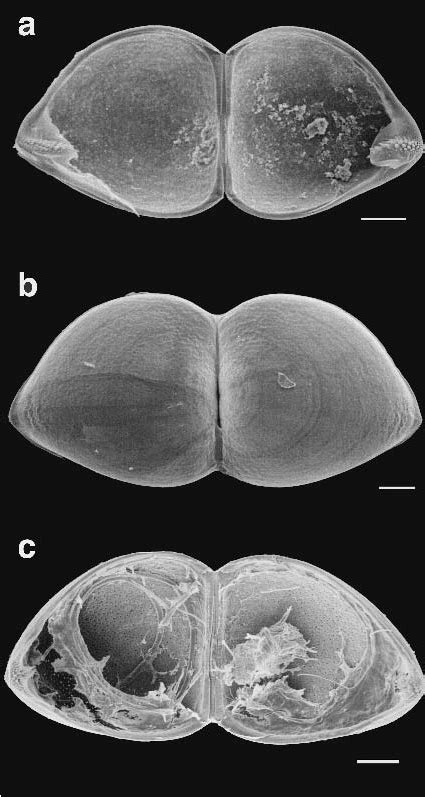 Scanning Electron Micrographs Showing The Shapes Of The Valves Of The