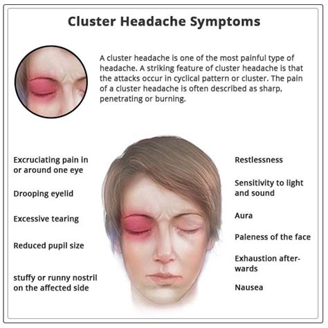 How To Deal With Cluster Headaches Outsiderough11