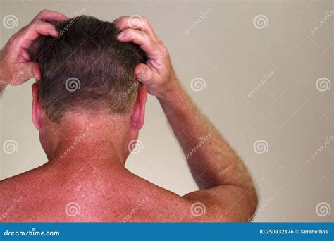 Rear View Of Both Hands Of A Mature Man Massaging His Head Close Up Stock Photo Image Of Hand