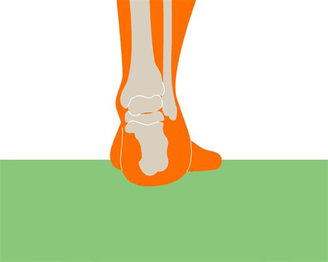 The Best Shoes For Achilles Tendonitis