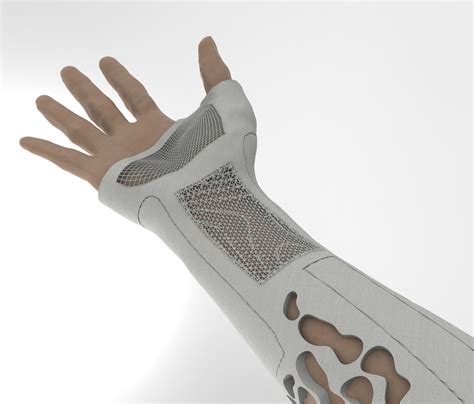 Custom Orthopaedic Arm Cast design :: Behance