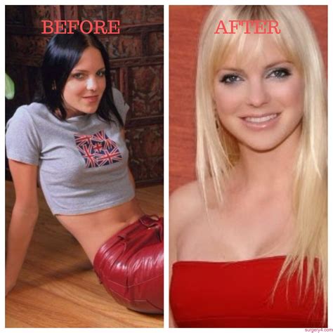 Anna Faris Plastic Surgery Photos [Before & After] - Surgery4