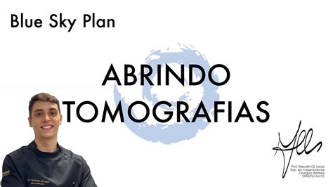 Tutoriais Blue Sky Plan Abrindo Tomografias YouTube