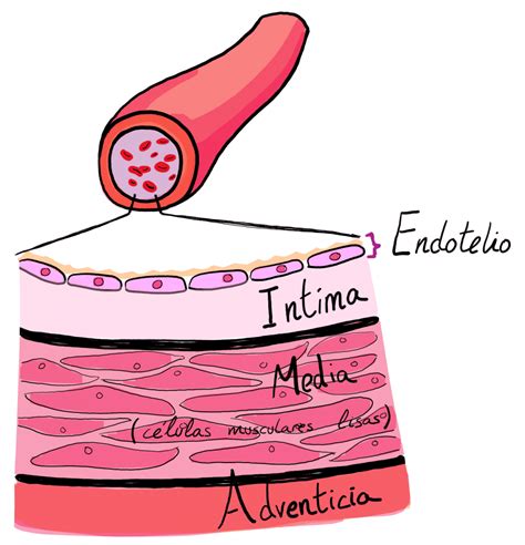 Qué es la aterosclerosis y cuál es el papel del colesterol LDL Be