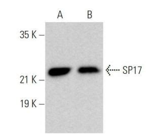 SP17 Antibody (A-12) | SCBT - Santa Cruz Biotechnology