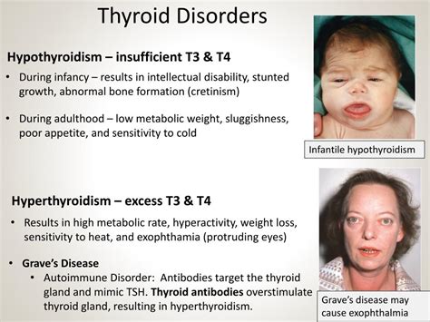 PPT - Endocrine System PowerPoint Presentation, free download - ID:2109764