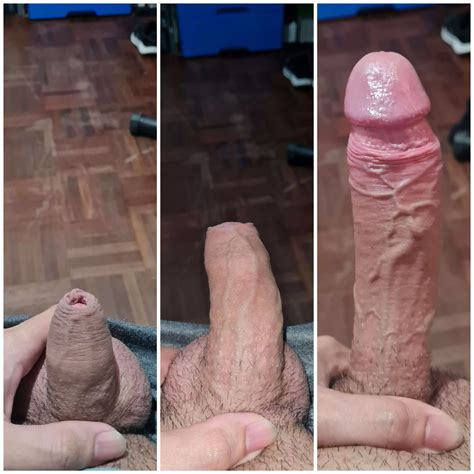 Stages Of A Grower Nudes Foreskin Nude Pics Org