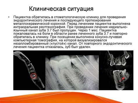 Лучевая диагностика в стоматологии - презентация онлайн