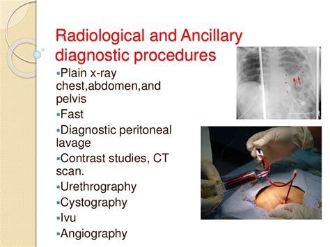 Abdominal Trauma