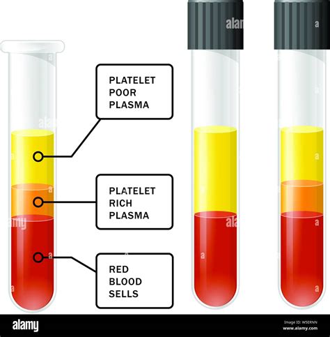 Prp Centrifuge High Resolution Stock Photography And Images Alamy