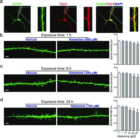 Effects Of Ketamine On Dendritic Spine Maturation In MSNs A