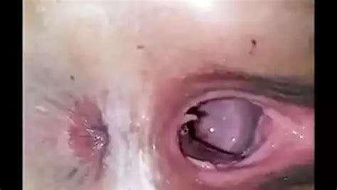 Old Wide Open Cunt Hole Pussy Pussy Porn Xhamster