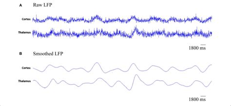 | The simulated LFP of thalamic and cortical networks. (A) Raw LFP ...