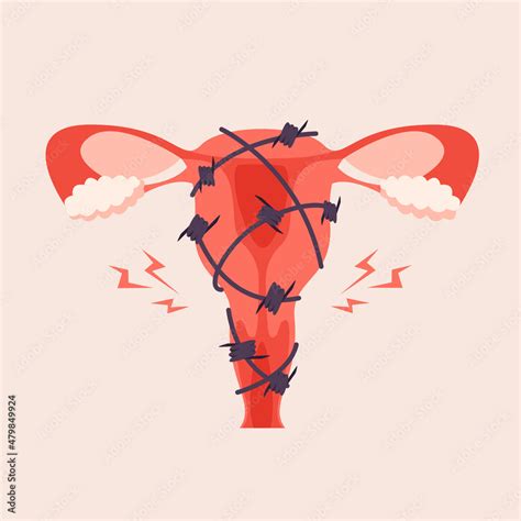 Painful Menstruation Concept Trendy Flat Illustration Uterus