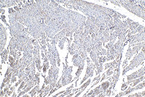 IHCeasy CKB Ready-To-Use IHC Kit KHC0325 | Proteintech | 武汉三鹰生物技术有限公司