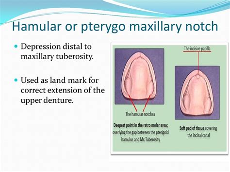 Anatomical Landmarks For Complete Dentures