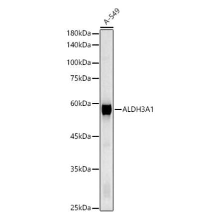 ALDH3A1 Antibodies | Antibodies.com