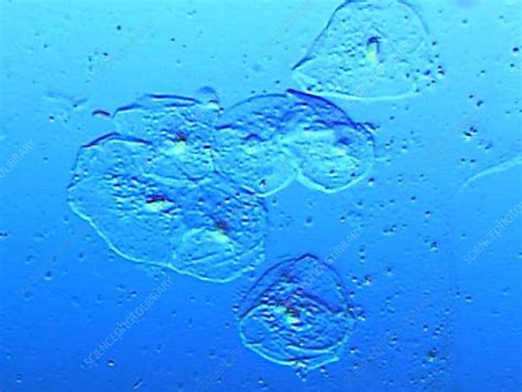 Human cheek cells - Stock Video Clip - K002/1619 - Science Photo Library