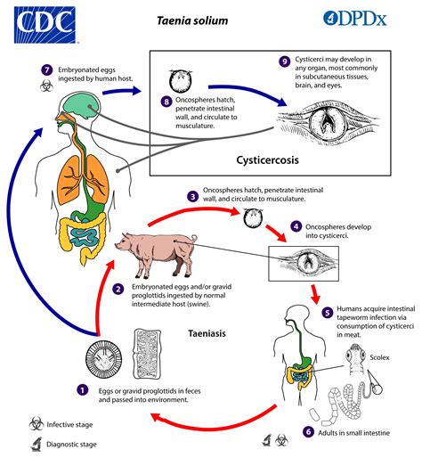 ¿cómo Sé Si Tengo Una Lombriz Solitaria En Mis Intestinos Estos Son