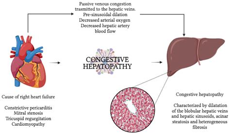 The Liver in Heart Failure: From Biomarkers to Clinical Risk