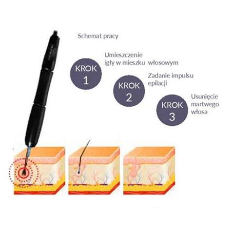 biomak EP300 Эпилятор-коагулятор купить по цене 32000 руб. в интернет ...