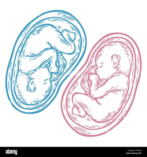 Human Embryo Twins