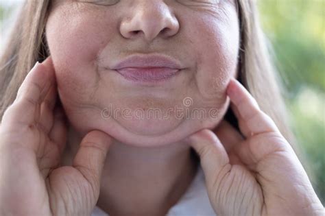 Closeup Face Mature Woman Years Old Human Fat Neck Double Saggy Chin Aging And Facial
