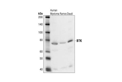 Btk Antibody Cell Signaling Technology