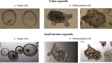 Images Of Colon And Small Intestine Organoids Obtained Two Distinct