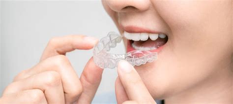 Conhe A Os Principais Tipos De Brocas Odontol Gicas Surya Dental