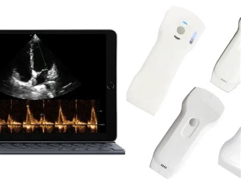 Handheld Doppler Ultrasound Compact And Portable Diagnostic Tool